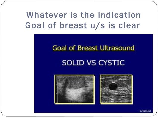 solid breast tumor Solid breast tumor